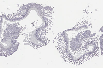 Cat ileum