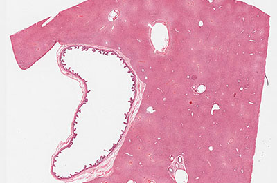 Primate liver and gall bladder