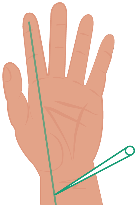 Electrode recording from afferent nerve